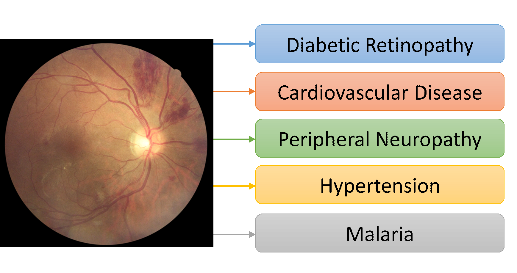 the-challenges-of-implementing-a-nationwide-retina-screening-program